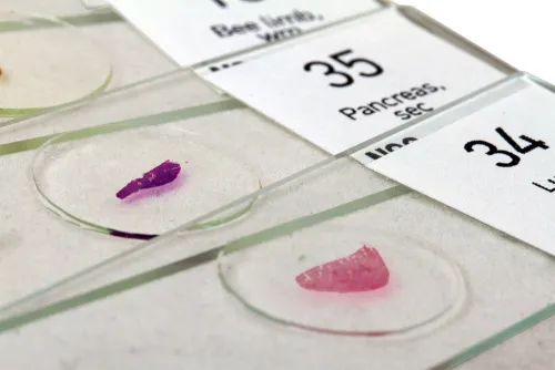 картинка комплект проби „Вижте всичко!“ Levenhuk N80 NG,  6