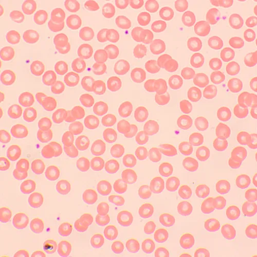 картина биологичен цифров микроскоп MAGUS Bio D250TL,  26