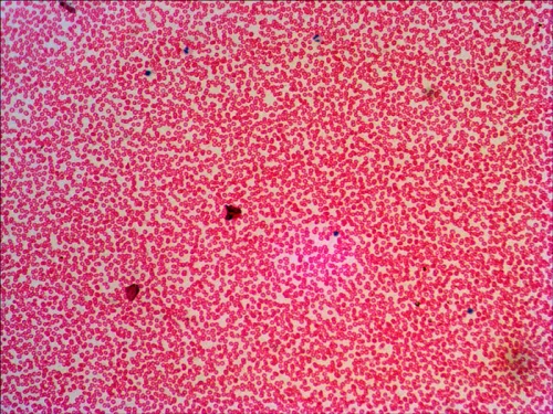 картина комплект подготвени проби Levenhuk N38 NG,  16